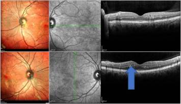 AskTheOCT-Expert_Bild1